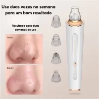 Aparelho Removedor de Cravos com Sução Vácuo e Ajustes - Beleza e Cuidados